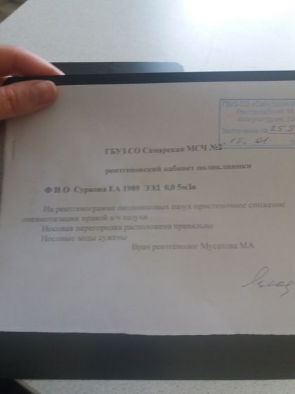 Гайморит. Снимок