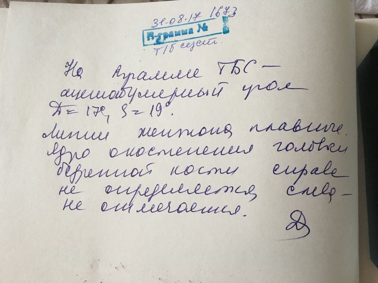 Ацетабулярный угол ТЗБ