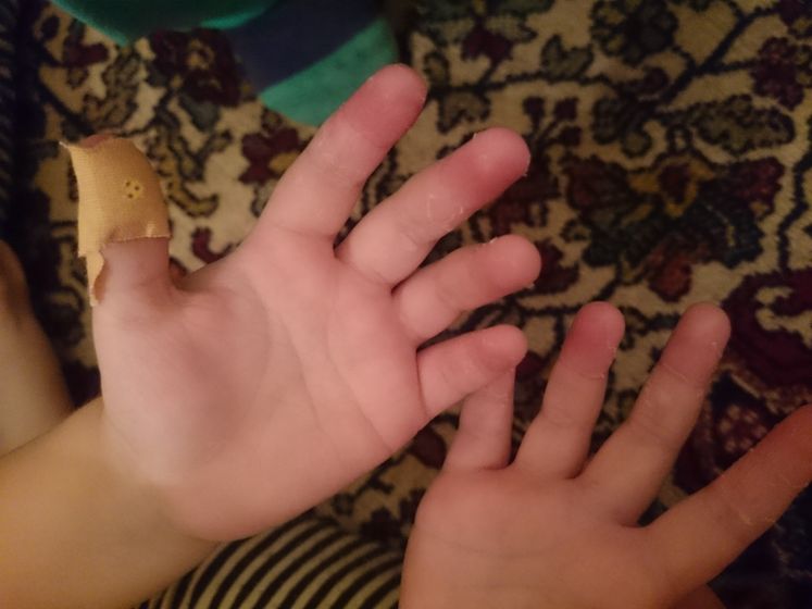 Help(((