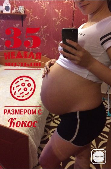 35 weeks??