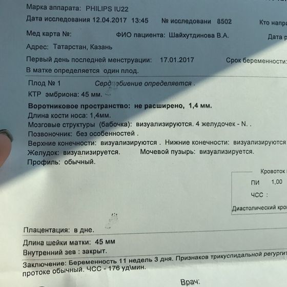 Сходили на скрининг) ?ощущения