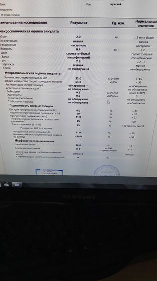 Спермограмма