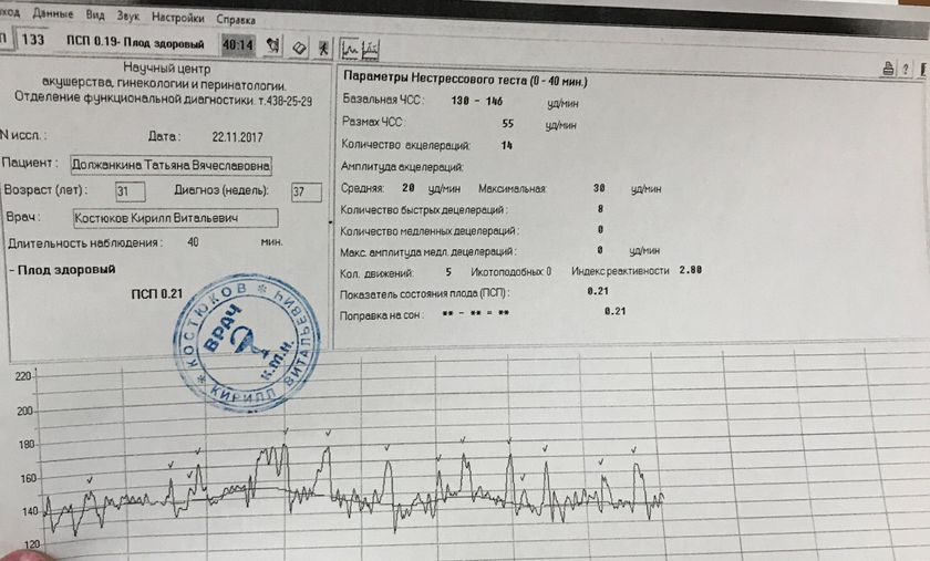 Легла на дородовую госпитализацию