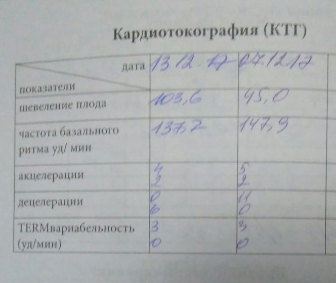 2ое КТГ в 34.6 недель 👶📈📉