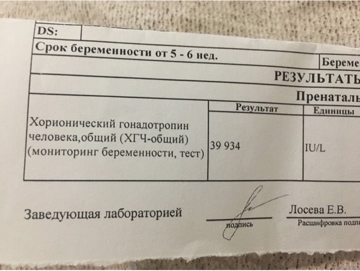 Хгч