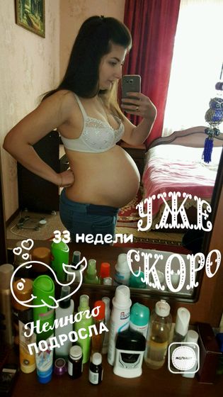 33 недельки🎉