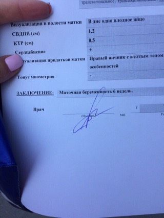Первое УЗИ 26 июля 2017 года ❤