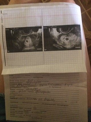 Хорошая новость)
