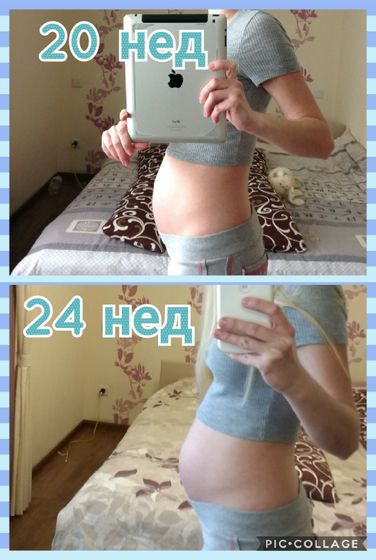Вторая Б - 24 недели 😊👶 (встала на учёт, фото животика)