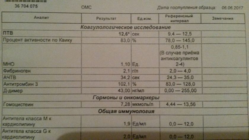 Анализ