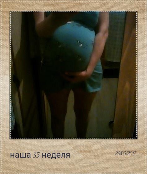 Сегодня наша 35 неделька,почти