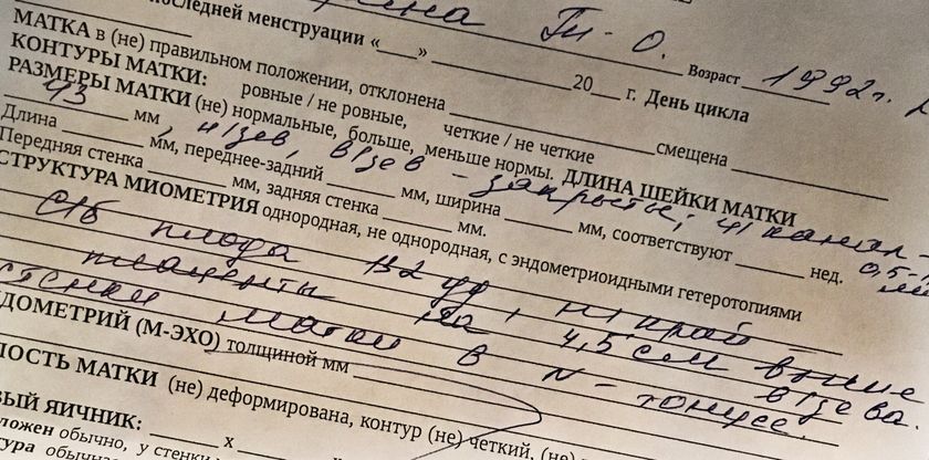 Шейка 43 мм и всё закрыто! ???