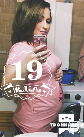 19 недель. Тройня. Пол малышей.