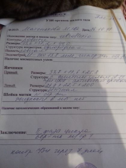 Узи