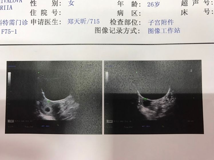 Наше начало🤰🏼