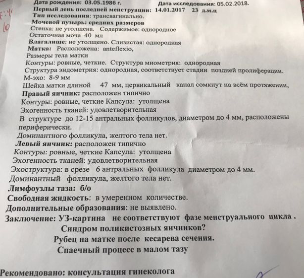 УЗИ фолликулогенеза, со мной что-то не так!