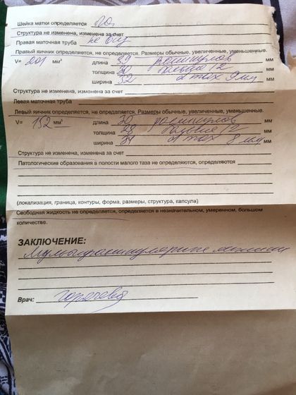 Узи