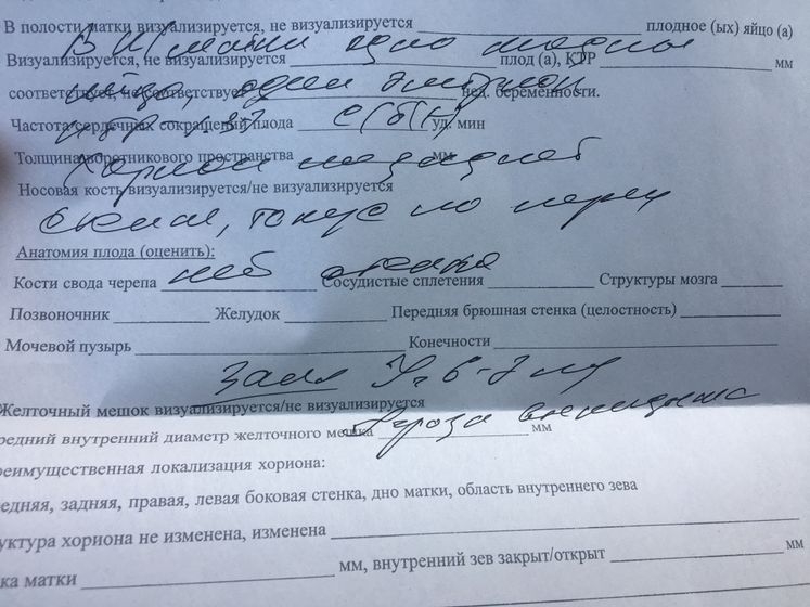 УЗИ