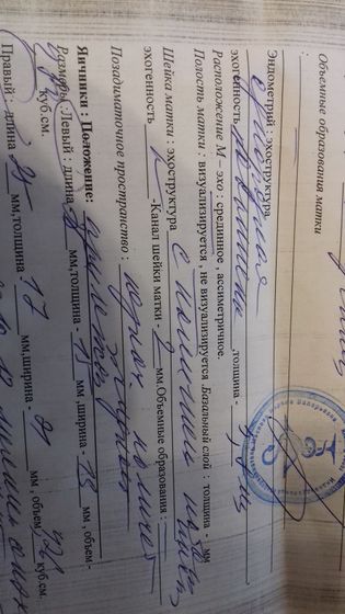 Фото моего узи